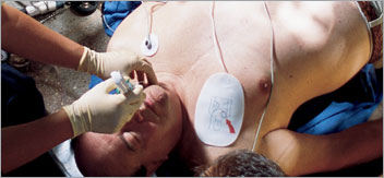Comment choisir un défibrillateur ?