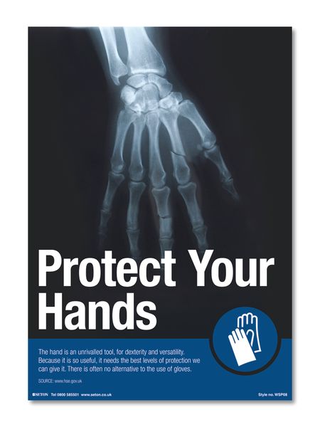 Protect Your Hands Safety Posters