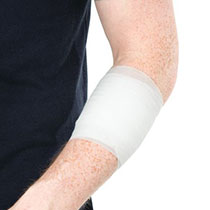 Arm dressed with a conforming bandage